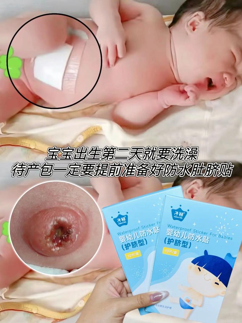 新生儿脐带脱落后多久能沾水？-第2张图片-中州医学会