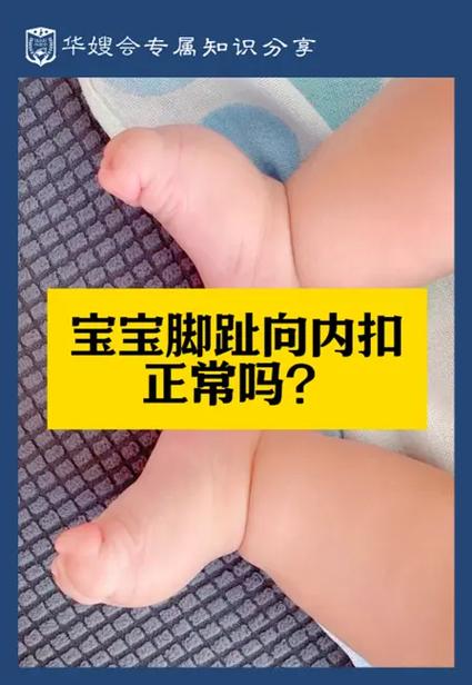 新生儿脚趾甲长肉里咋办？-第3张图片-中州医学会