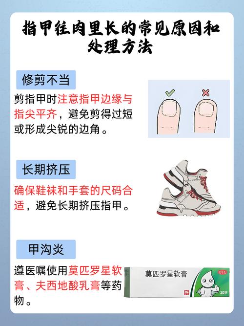 新生儿脚趾甲长肉里咋办？-第2张图片-中州医学会