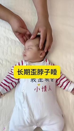 新生儿歪头睡要纠正吗？-第2张图片-中州医学会