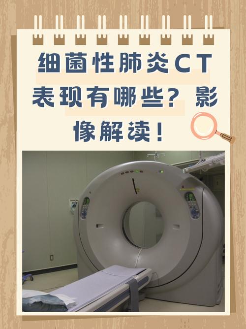 儿童肺炎CT检查间隔多久合适？-第2张图片-中州医学会