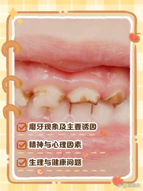 儿童晚上磨牙是缺钙还是压力大？-第3张图片-中州医学会