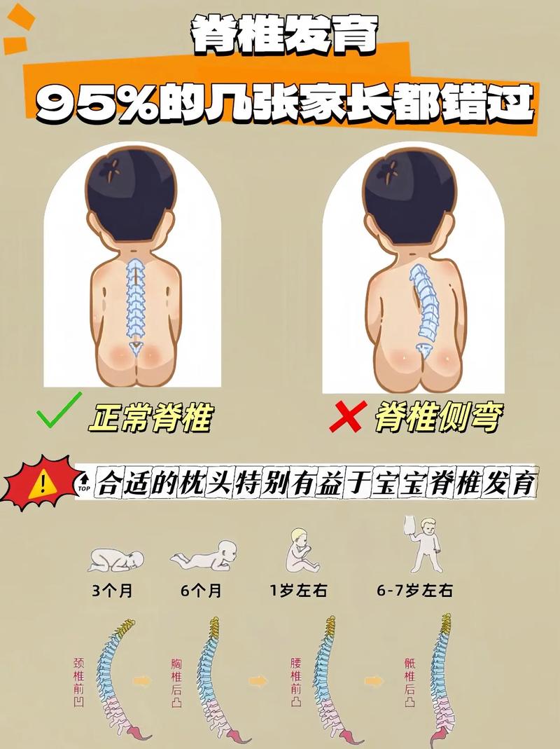 新生儿隐形脊柱裂症状有哪些？-第2张图片-中州医学会