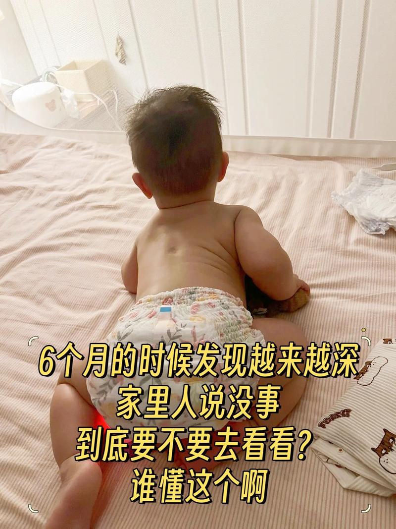 新生儿隐形脊柱裂症状有哪些？-第3张图片-中州医学会