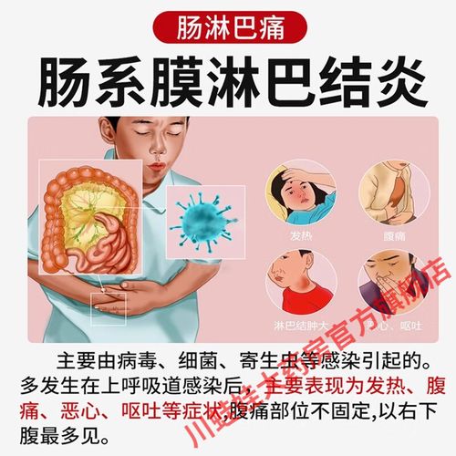 儿童肠系膜淋巴结炎能自愈吗？-第3张图片-中州医学会