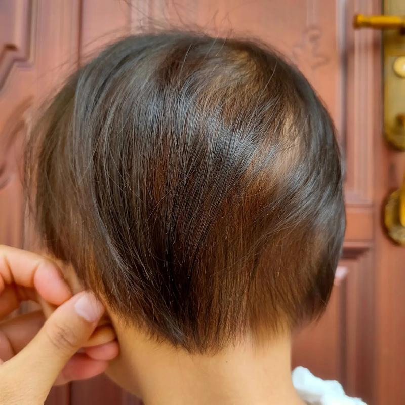 儿童头发黄是缺营养还是其他原因？-第3张图片-中州医学会