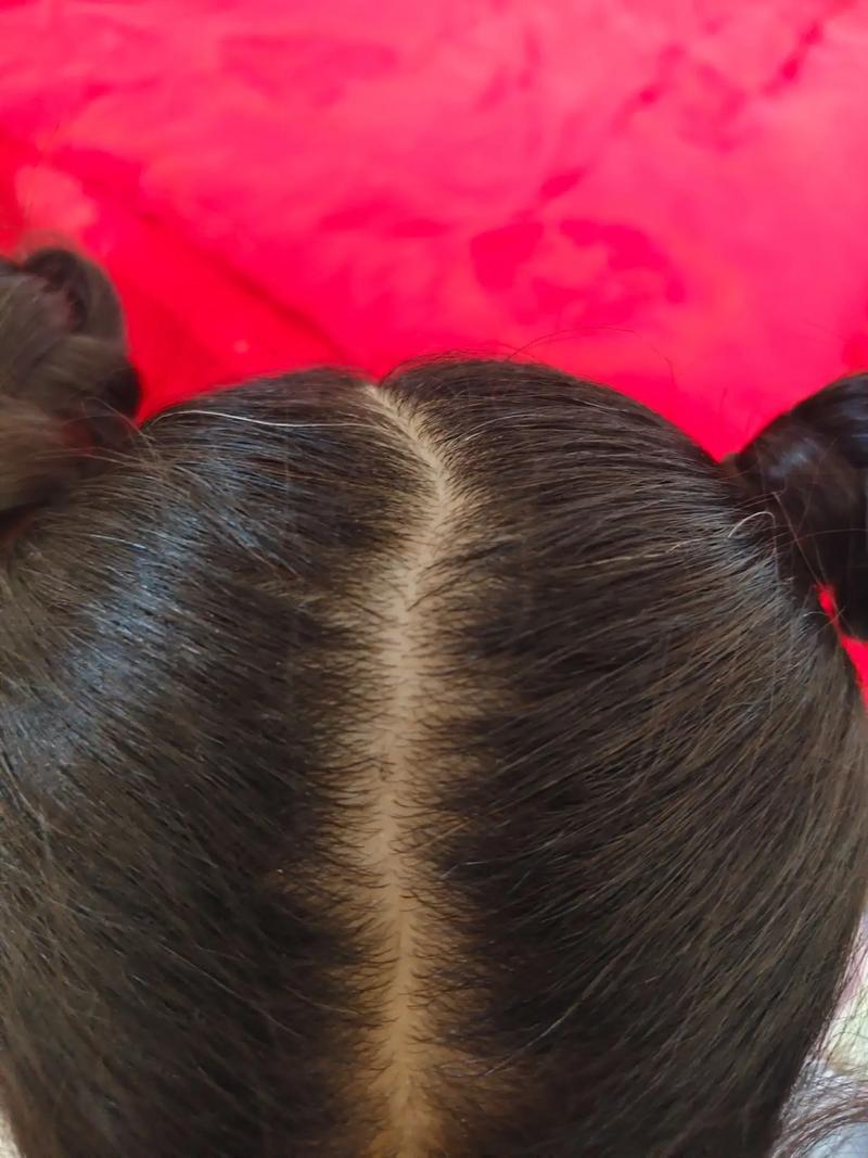 儿童头发黄是缺营养还是其他原因？-第2张图片-中州医学会