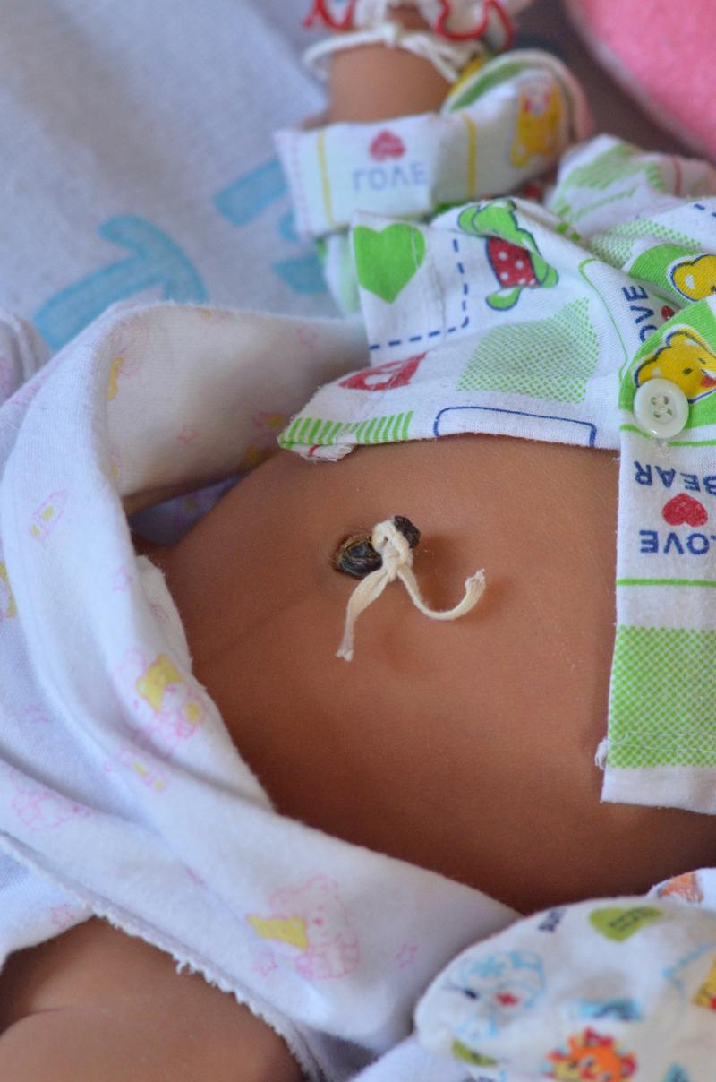 新生儿肚脐脱落后多久能碰水？-第1张图片-中州医学会