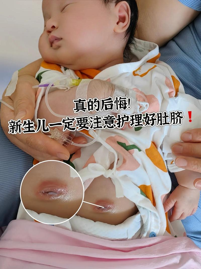 新生儿肚脐脱落后多久能碰水？-第3张图片-中州医学会