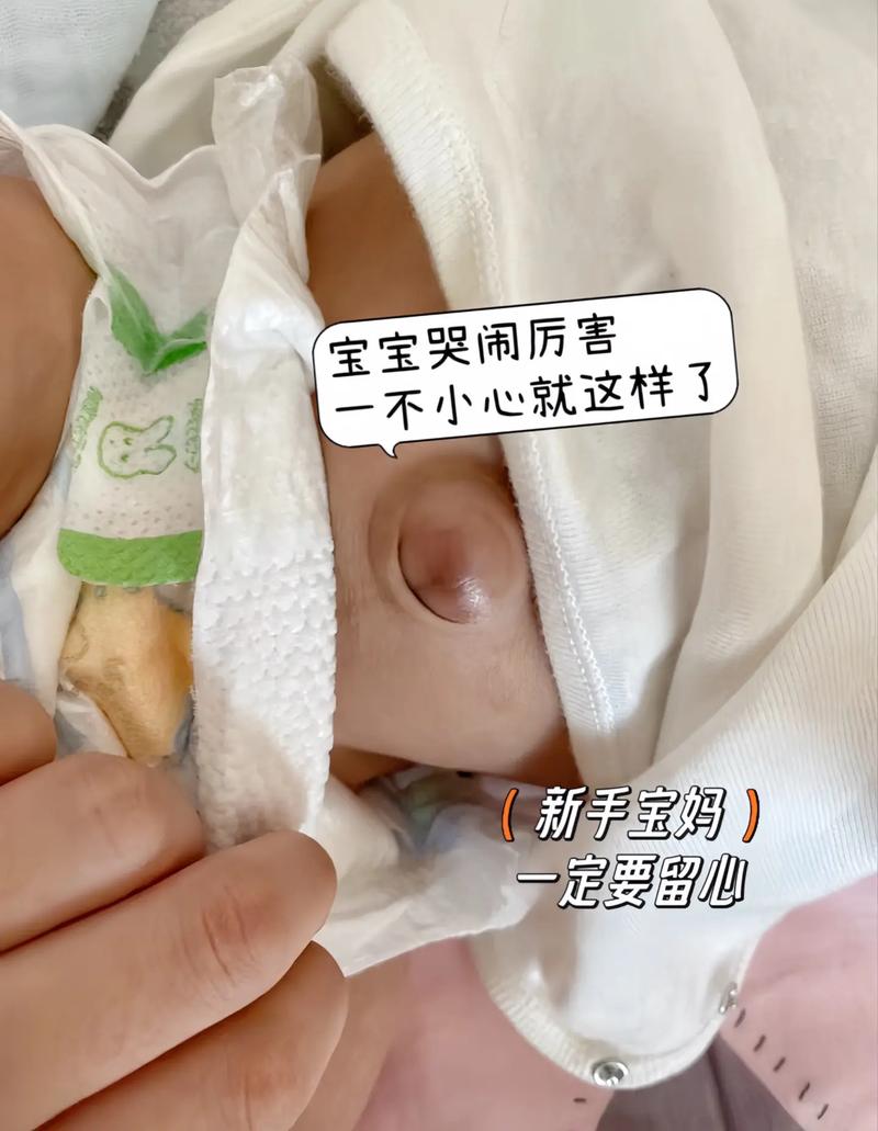 新生儿肚脐脱落后多久能碰水？-第2张图片-中州医学会