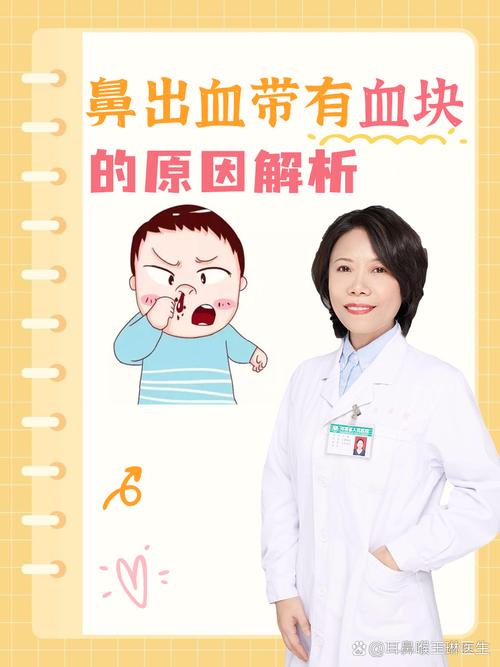 孕期鼻血是何原因导致？-第1张图片-中州医学会