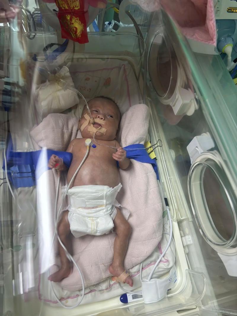 新生儿先天性心脏病有哪些典型症状？-第2张图片-中州医学会