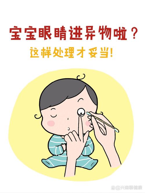 新生儿眼睛进异物该如何处理？-第2张图片-中州医学会