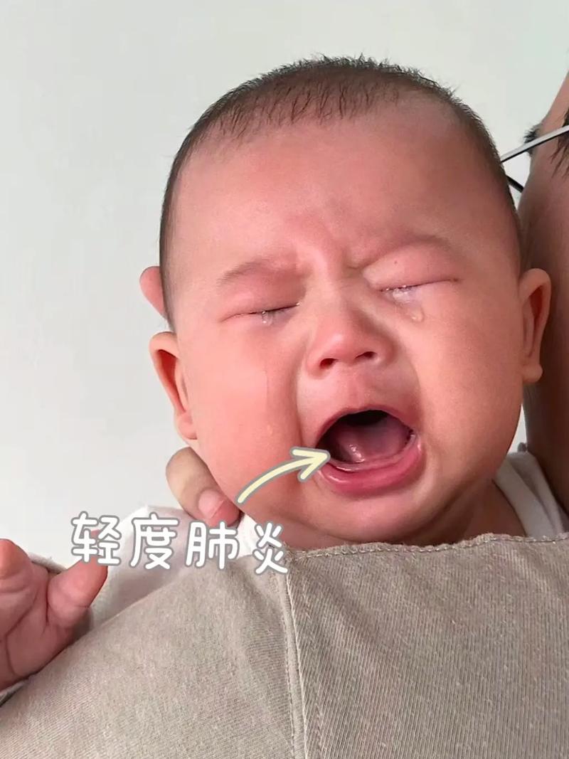 胎粪吸入性肺炎新生儿危险吗？-第2张图片-中州医学会