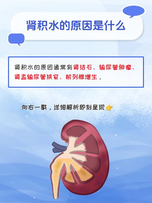 孕期为何致胎儿肾积水？-第3张图片-中州医学会