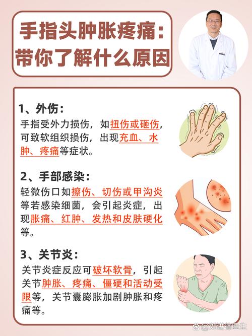 孕期手指关节痛,是缺钙还是激素变化?-第1张图片-中州医学会 孕期手指关节痛,是缺钙还是激素变化?-第1张图片-中州医学会