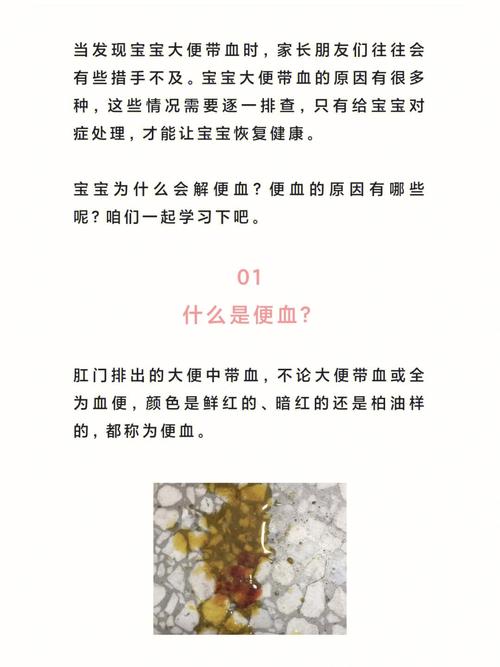 新生儿便便有血丝是何原因？-第2张图片-中州医学会