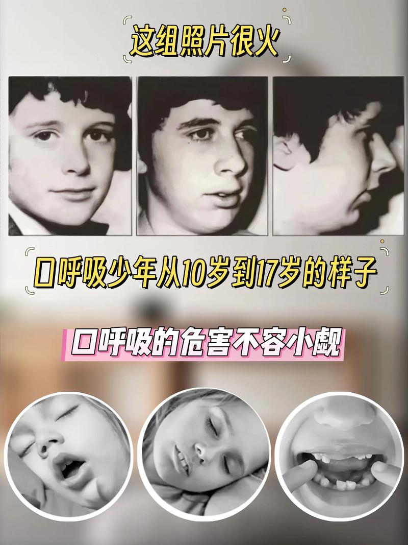 新生儿用嘴呼吸是何原因？-第2张图片-中州医学会