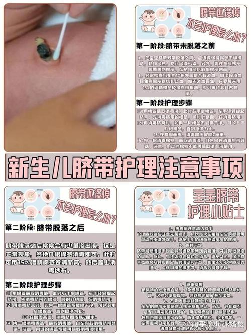 新生儿脐带脱落后出血，怎么办？-第2张图片-中州医学会