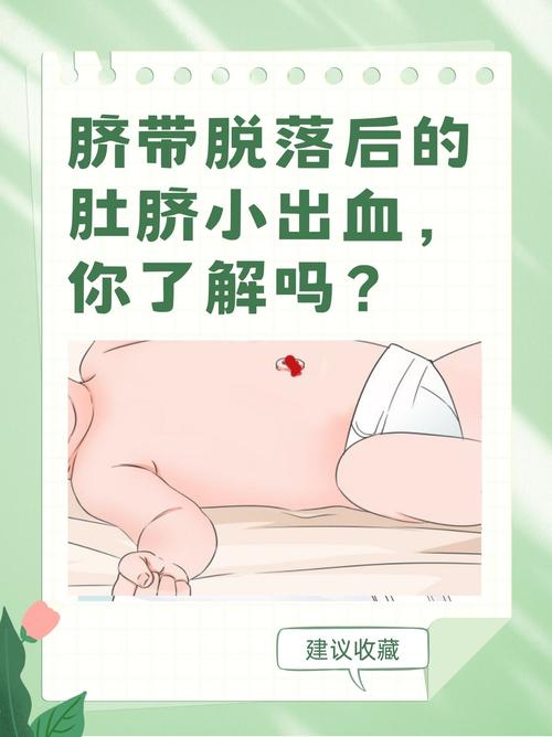 新生儿脐带脱落后出血，怎么办？-第3张图片-中州医学会