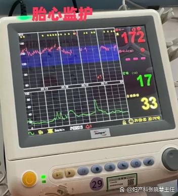 9岁儿童心跳110正常吗？需关注吗？-第3张图片-中州医学会