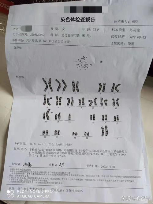 新生儿染色体检查多久能出结果？-第2张图片-中州医学会