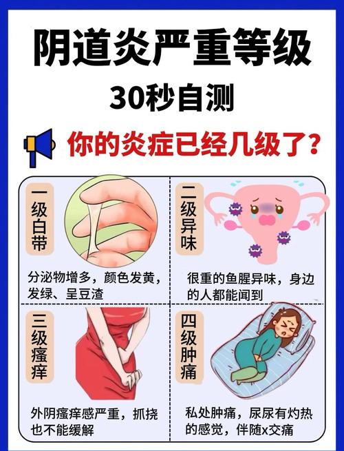 孕期私处痒是何原因?-第1张图片-中州医学会 孕期私处痒是何原因?-第1张图片-中州医学会