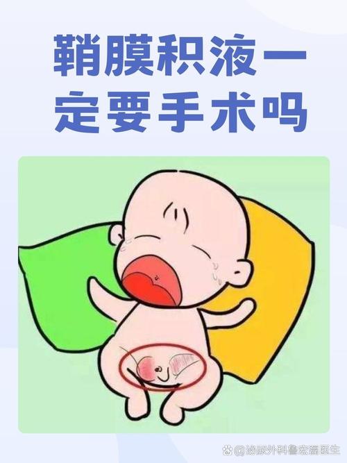 新生儿鞘膜积液因何形成?-第2张图片-中州医学会 新生儿鞘膜积液因何形成?-第2张图片-中州医学会