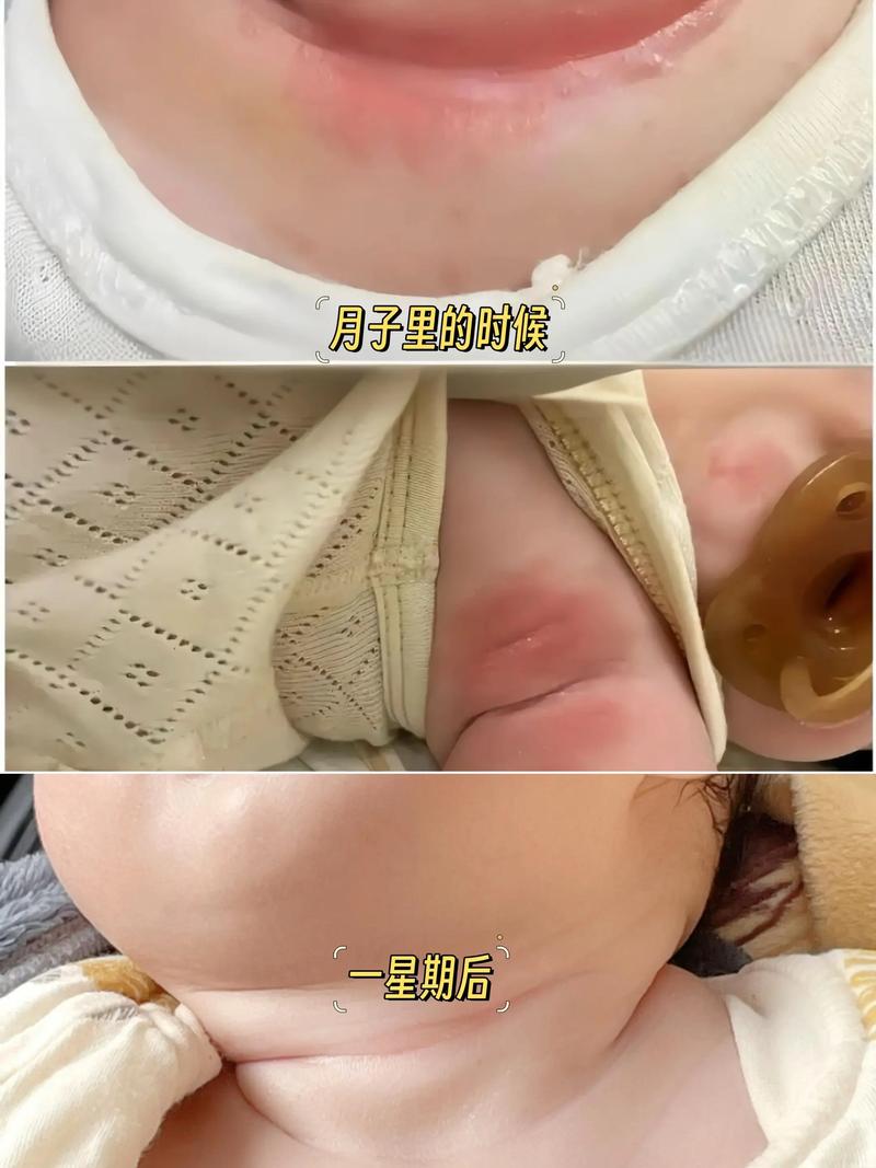 新生儿手脚热是捂多了吗？-第2张图片-中州医学会