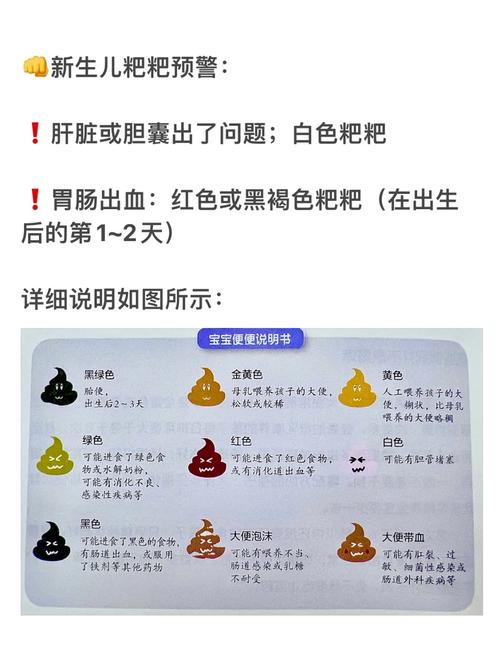 新生儿每天拉几次大便算正常？-第3张图片-中州医学会