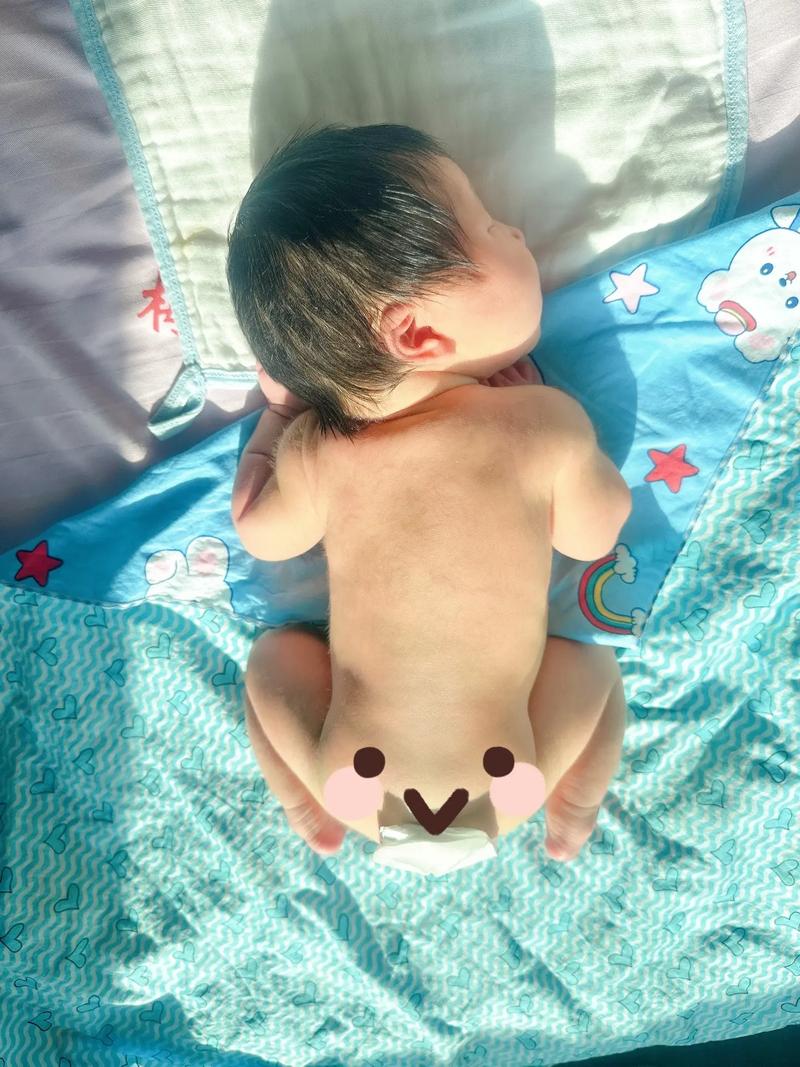 新生儿黄疸晒太阳晒哪个部位？-第1张图片-中州医学会