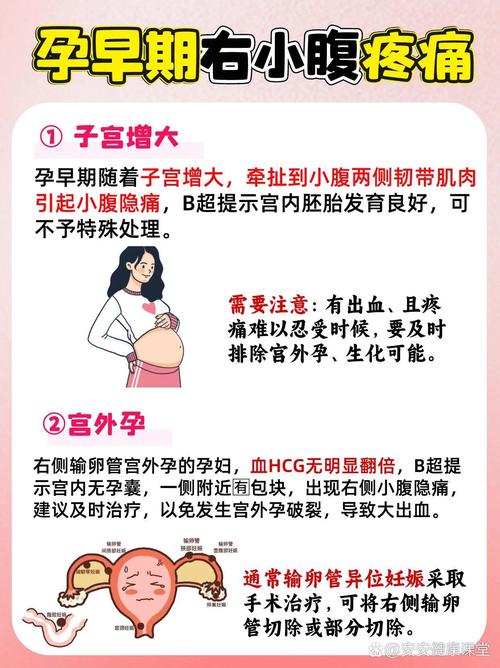 孕期腹痛是正常反应还是危险信号？-第2张图片-中州医学会
