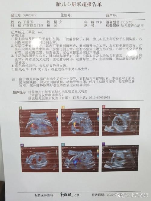 新生儿心脏彩超能查出哪些先心病？-第2张图片-中州医学会