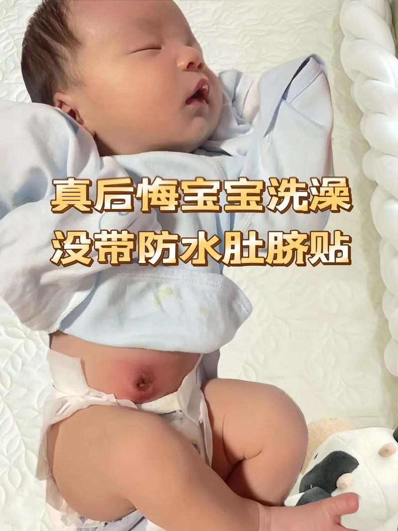 新生儿肚脐未脱落能洗澡吗？-第1张图片-中州医学会