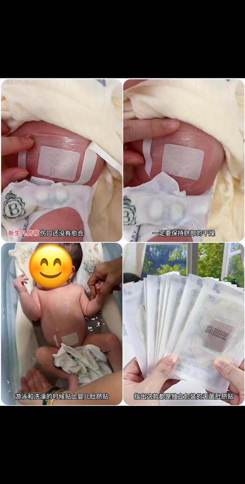 新生儿肚脐未脱落能洗澡吗？-第3张图片-中州医学会