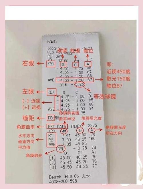 1岁儿童视力S和C正常值是多少？-第3张图片-中州医学会