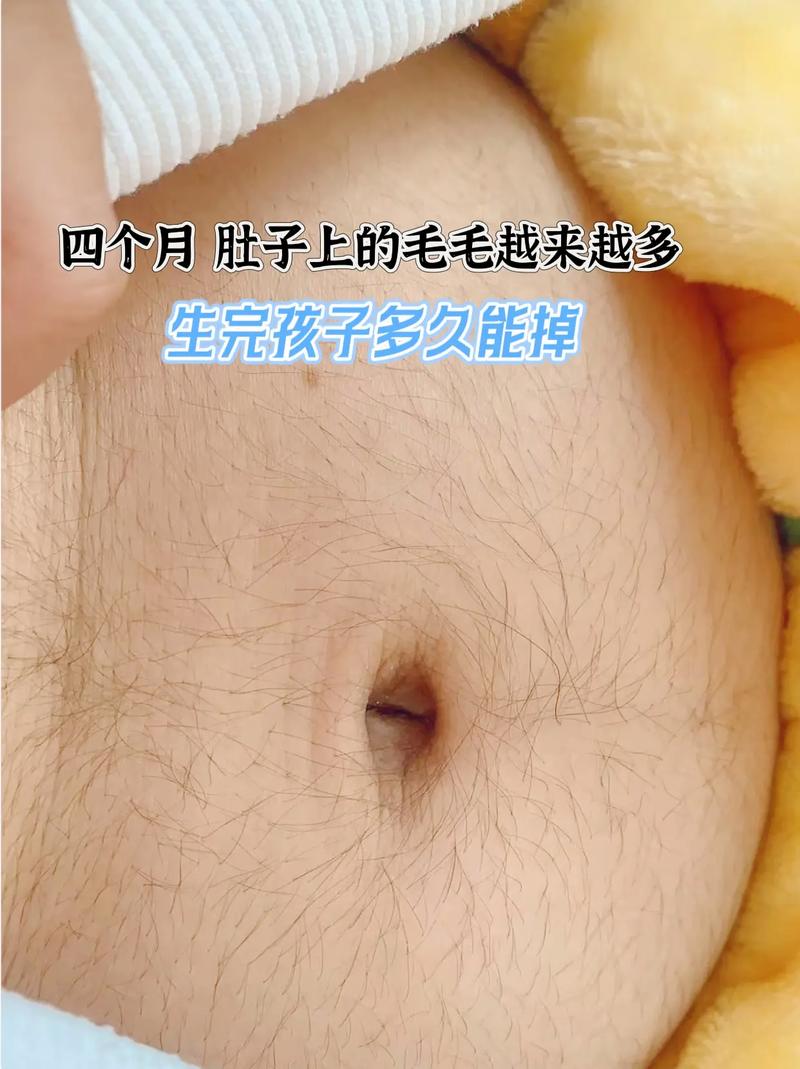 孕期肚子上长毛是怎么回事-第1张图片-中州医学会