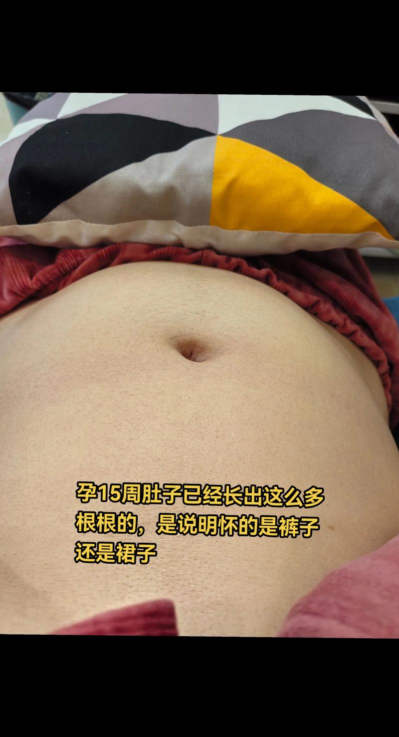 孕期肚子上长毛是怎么回事-第2张图片-中州医学会