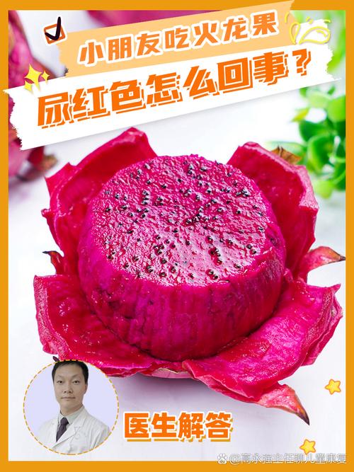 儿童吃火龙果尿红是正常吗？-第1张图片-中州医学会