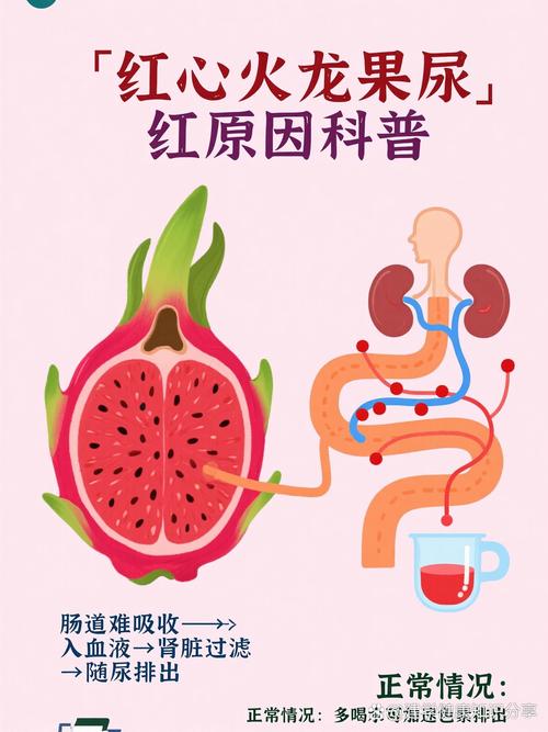 儿童吃火龙果尿红是正常吗？-第2张图片-中州医学会