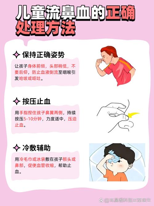 七岁儿童经常流鼻血怎么办?-第2张图片-中州医学会 七岁儿童经常流鼻血怎么办?-第2张图片-中州医学会