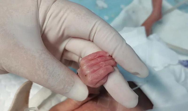 孕期25周胎儿发育如何?关键变化有哪些?-第2张图片-中州医学会 孕期25周胎儿发育如何?关键变化有哪些?-第2张图片-中州医学会