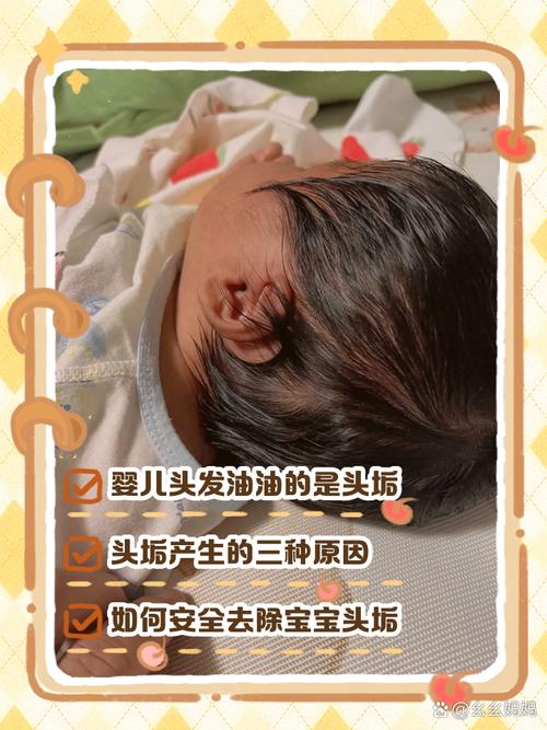 新生儿头发为何油油的？-第1张图片-中州医学会