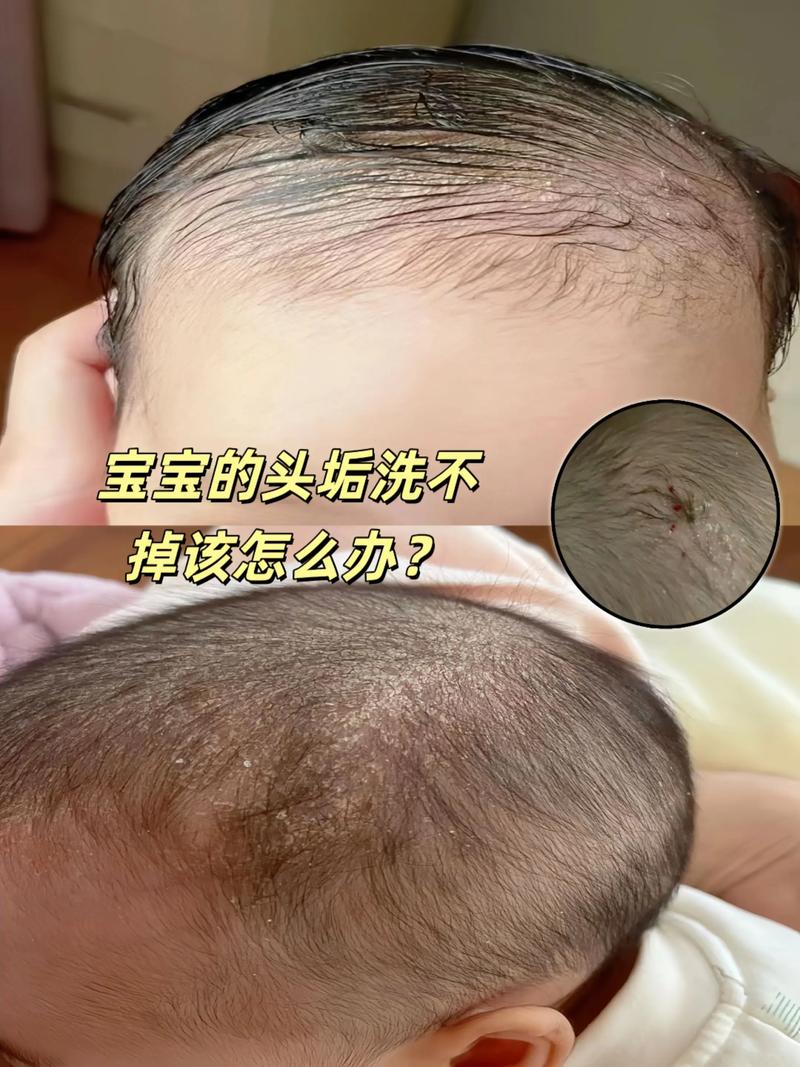 新生儿头发为何油油的？-第2张图片-中州医学会