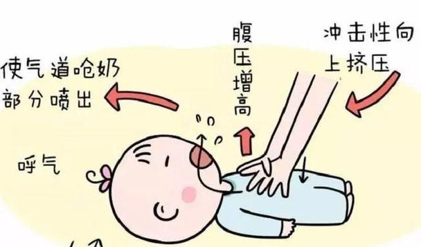 新生儿重度窒息的临床表现是-第2张图片-中州医学会