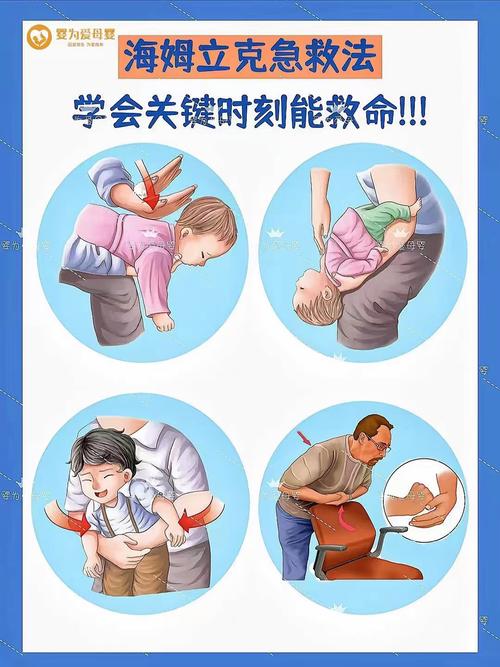 新生儿重度窒息的临床表现是-第3张图片-中州医学会