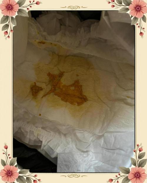 新生儿放屁带大便，是正常现象吗？-第1张图片-中州医学会