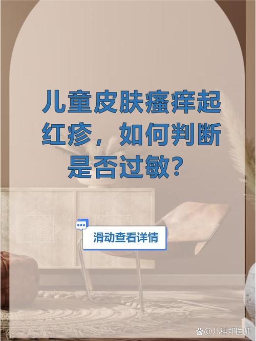 儿童全身瘙痒警惕哪些疾病？-第3张图片-中州医学会