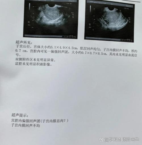 13岁女孩月经超10天怎么办？-第3张图片-中州医学会