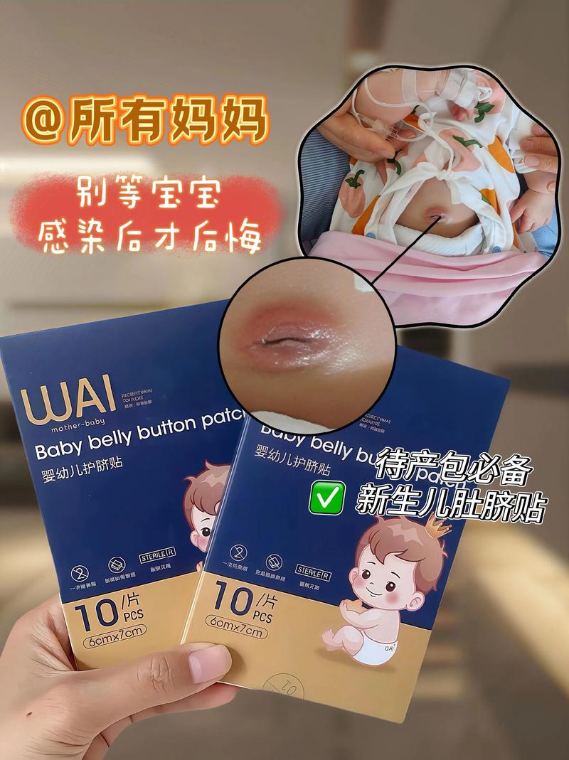 新生儿护脐带vs护脐贴，哪个更合适？-第3张图片-中州医学会